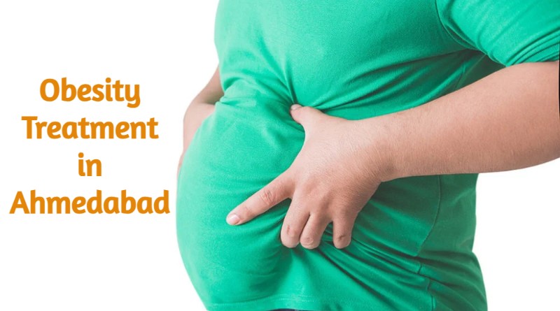 Best Obesity Treatment in Ahmedabad